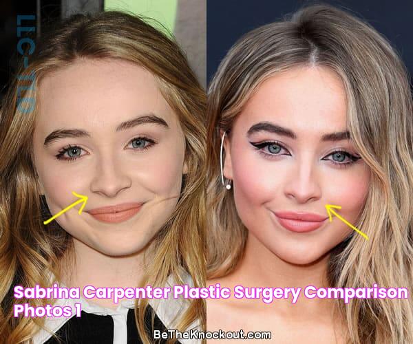 Sabrina Carpenter Plastic Surgery Comparison Photos