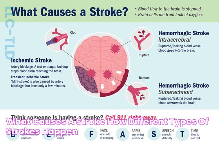 What Causes a Stroke? How Different Types of Strokes Happen