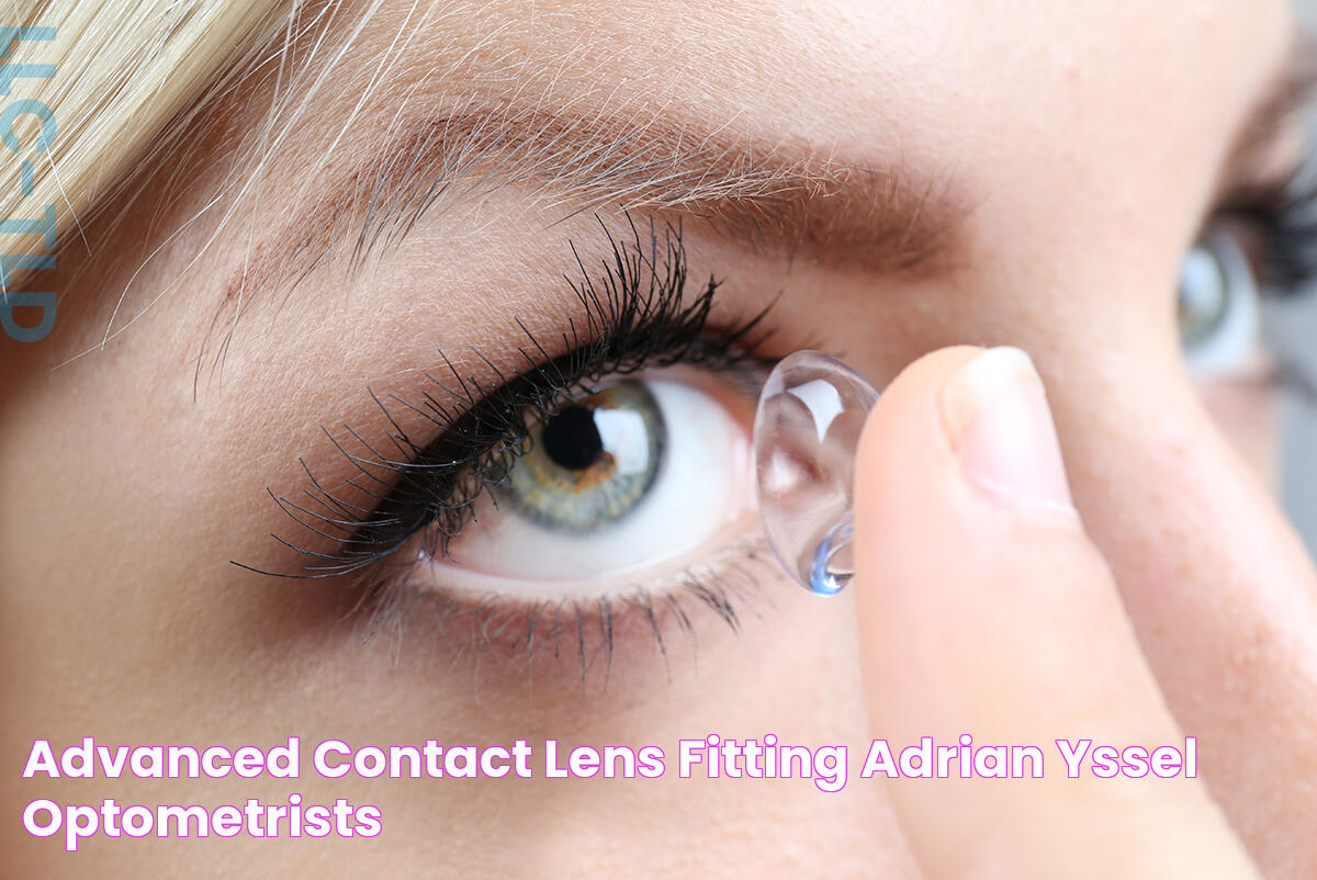 Advanced Contact Lens Fitting Adrian Yssel Optometrists