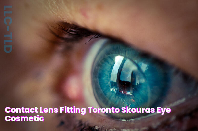 Contact Lens Fitting Toronto Skouras Eye & Cosmetic