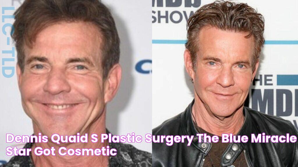 Dennis Quaid's Plastic Surgery The Blue Miracle Star Got Cosmetic