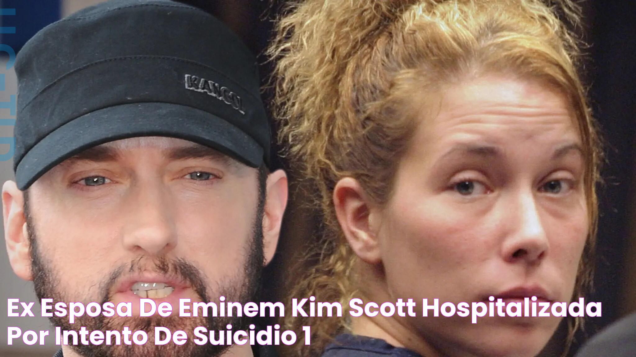 Ex esposa de Eminem, Kim Scott, hospitalizada por intento de suicidio