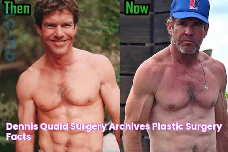 dennis quaid surgery Archives Plastic Surgery Facts