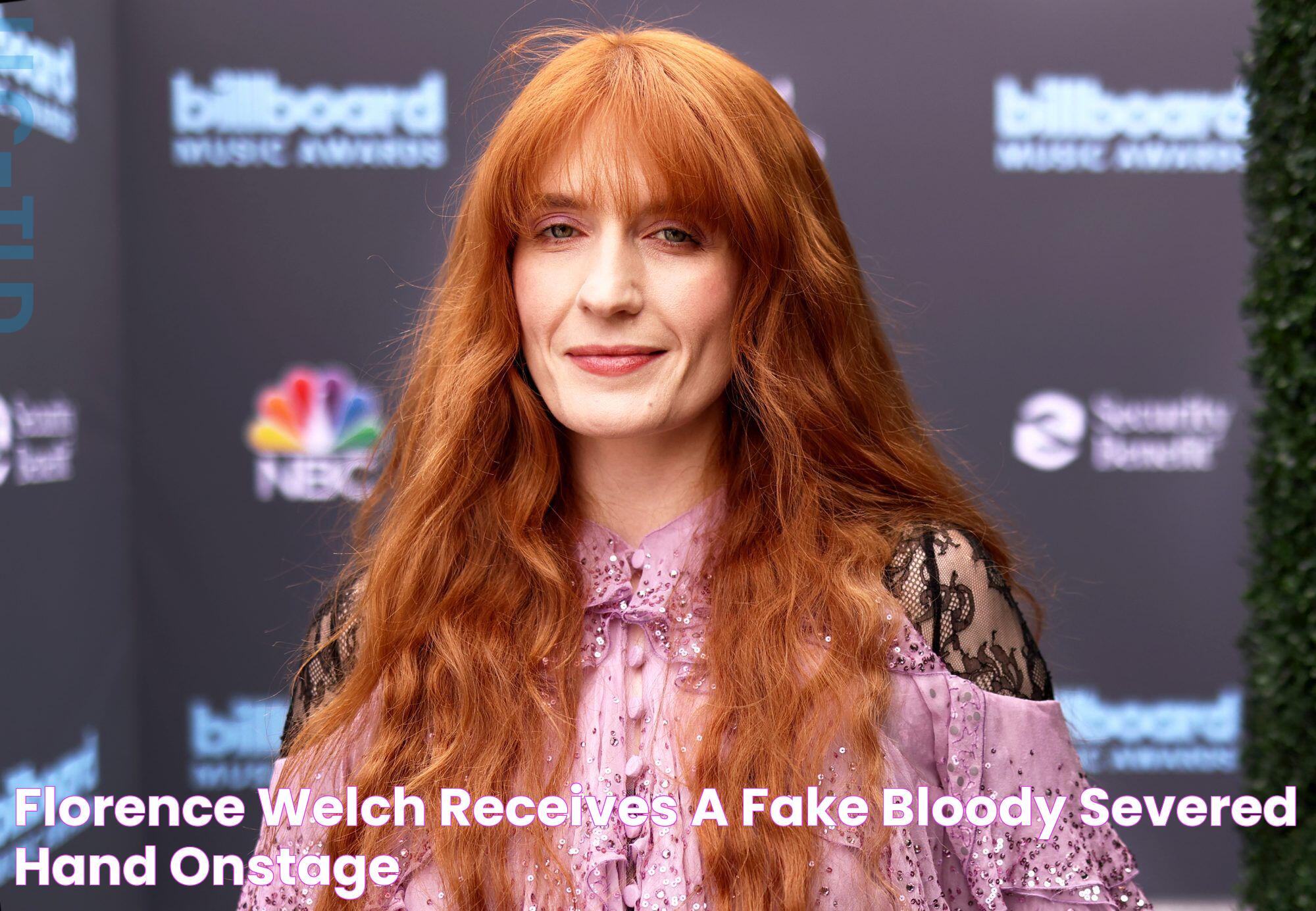 Florence Welch Receives a Fake 'Bloody Severed Hand' Onstage