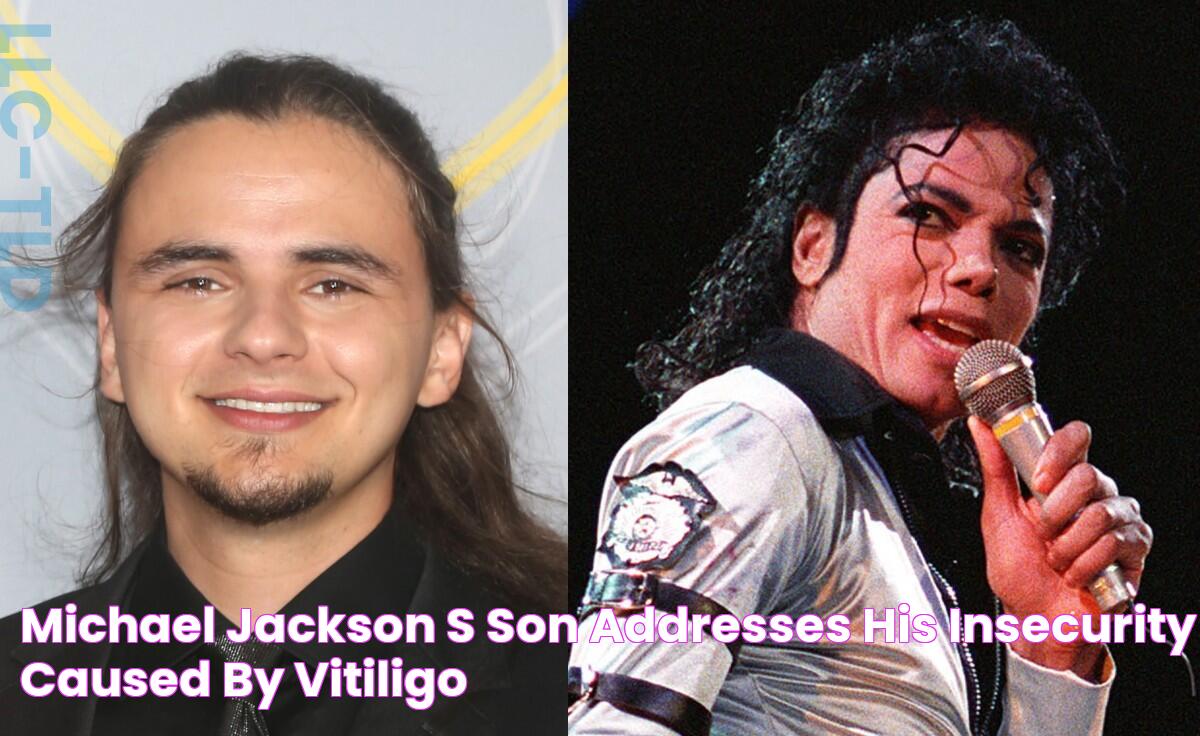 Michael Jackson's Son Addresses His 'Insecurity' Caused By Vitiligo