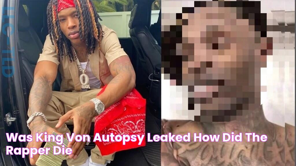 Was King Von Autopsy Leaked? How Did The Rapper Die?