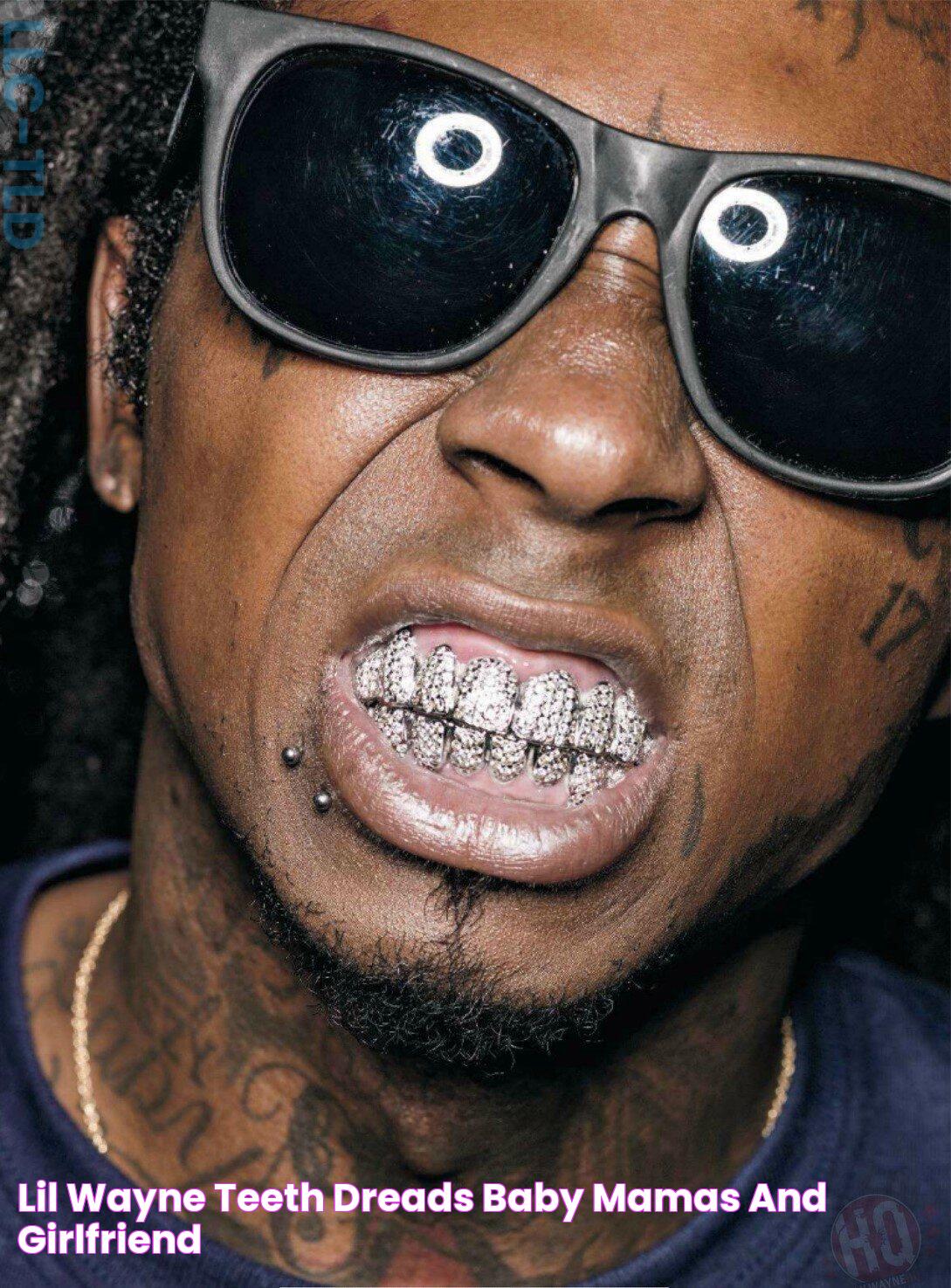 Lil Wayne Teeth, Dreads, Baby Mamas And Girlfriend