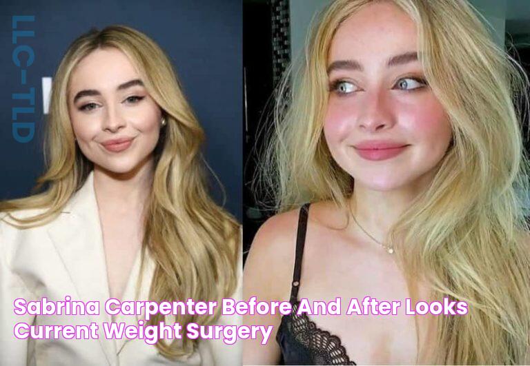 Sabrina Carpenter Before and After Looks, Current Weight, Surgery