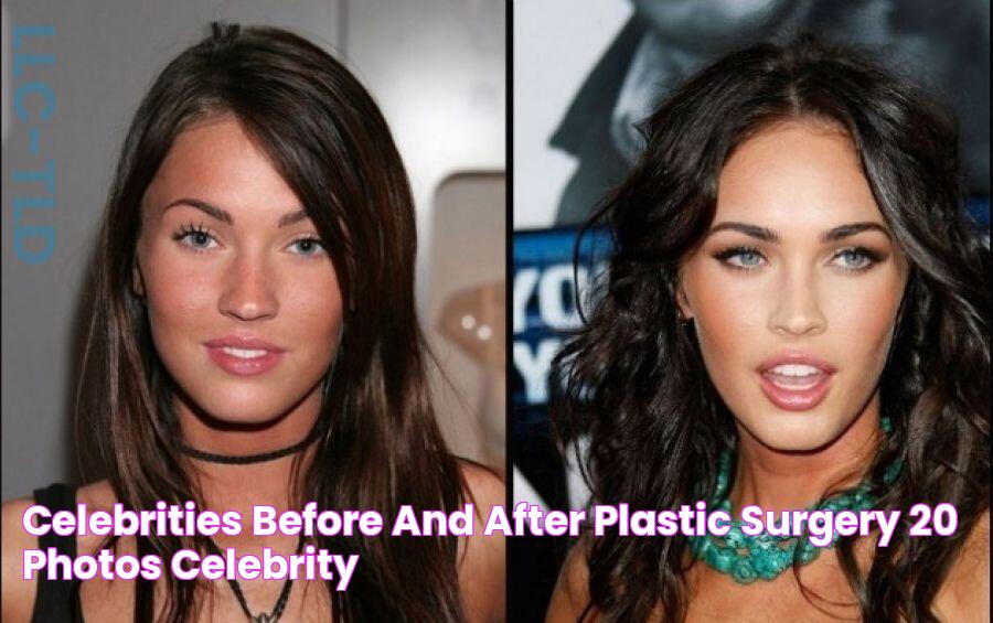 Celebrities Before And After Plastic Surgery (20 PHOTOS) Celebrity