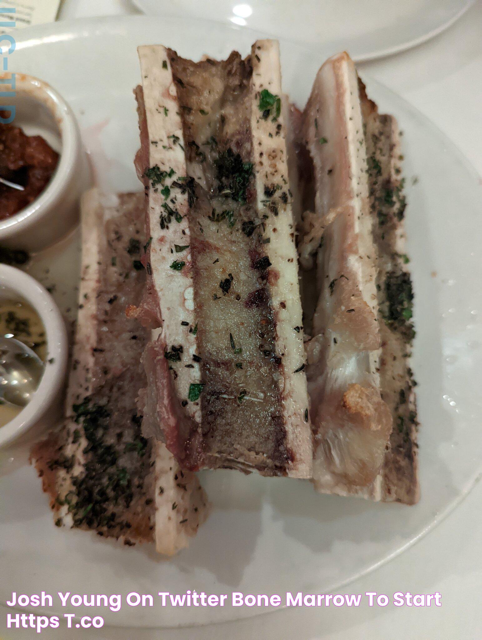 Josh Young 🦬🛢️ on Twitter "Bone marrow to start https//t.co