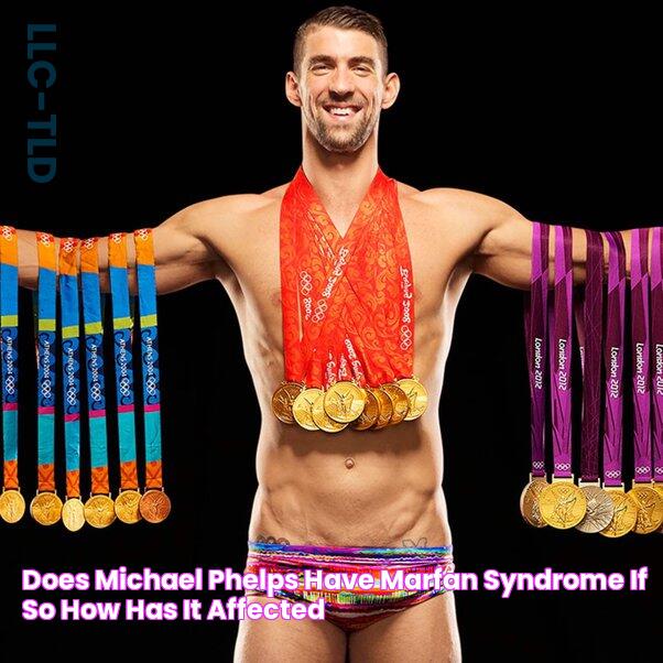 Does Michael Phelps have Marfan syndrome? If so, how has it affected