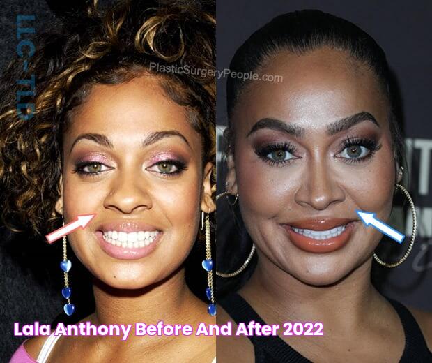 Lala Anthony, BEFORE and AFTER 2022