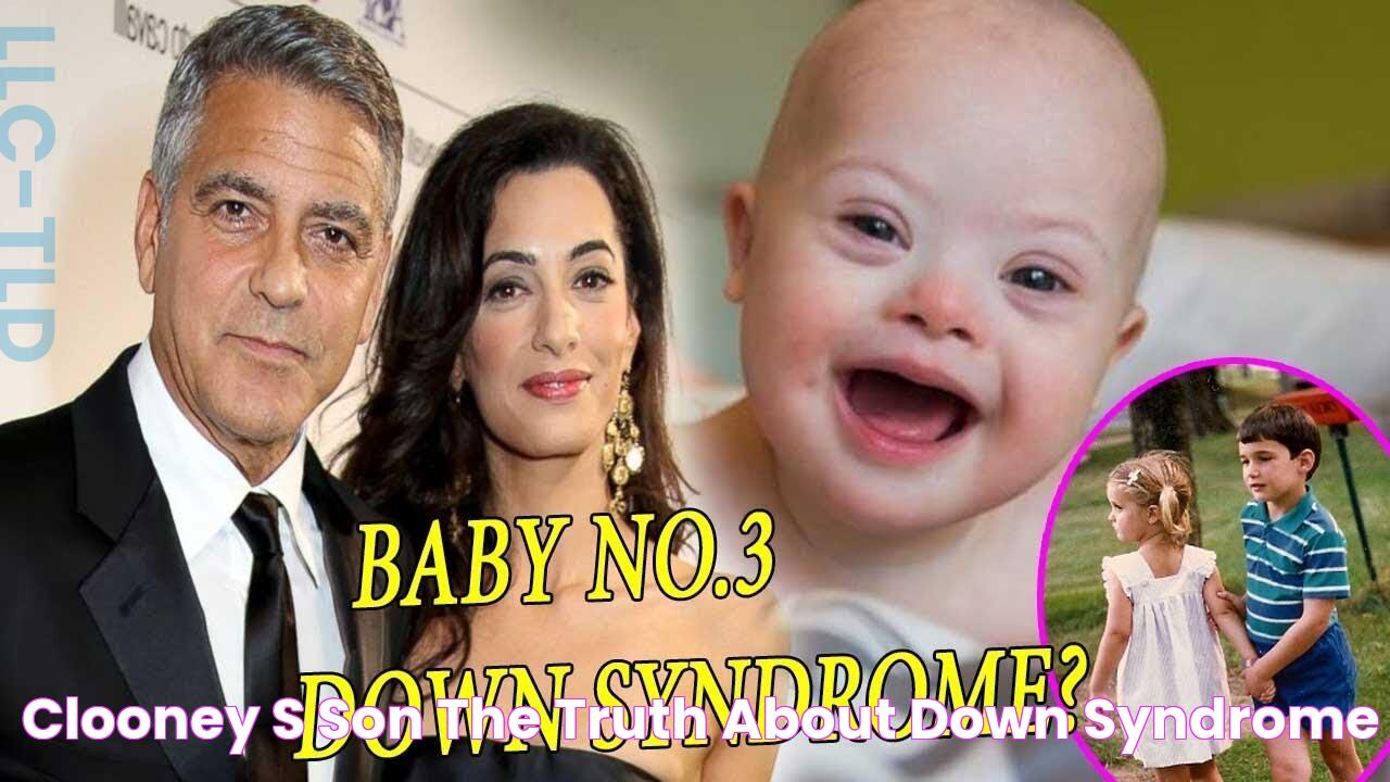 Clooney's Son The Truth About Down Syndrome