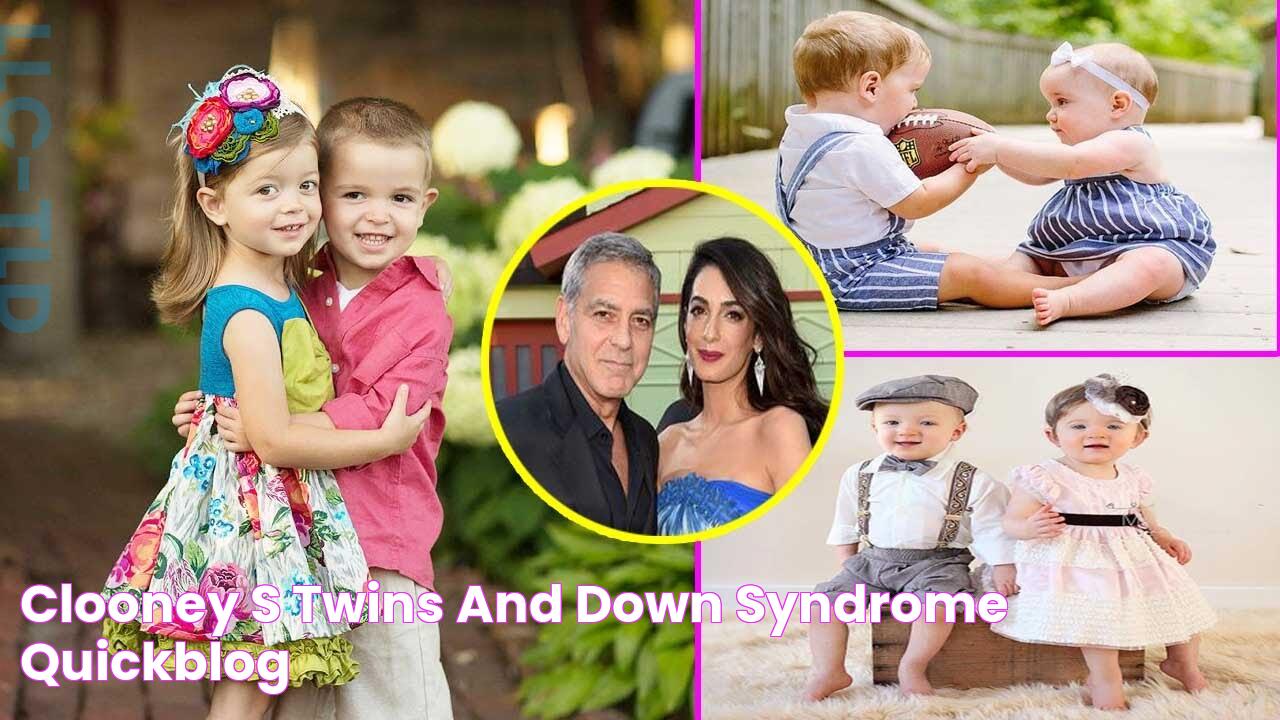 Clooney's Twins And Down Syndrome QuickBlog