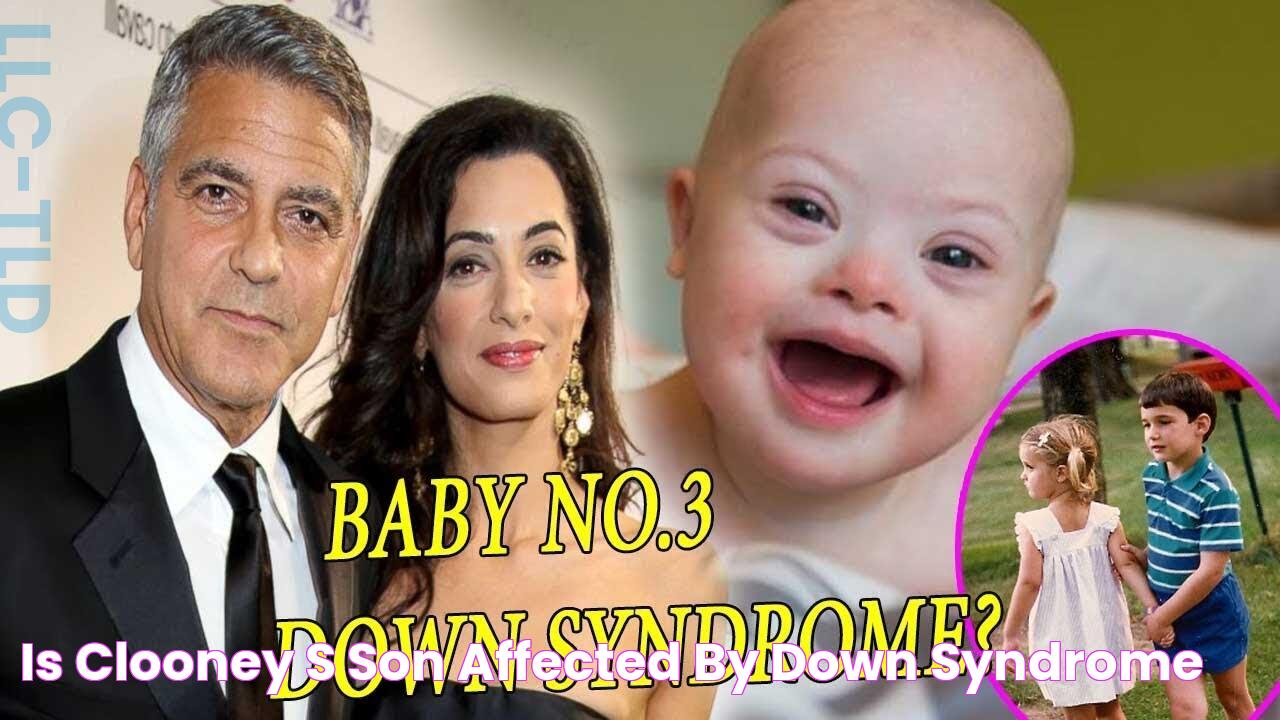 Is Clooney's Son Affected By Down Syndrome?