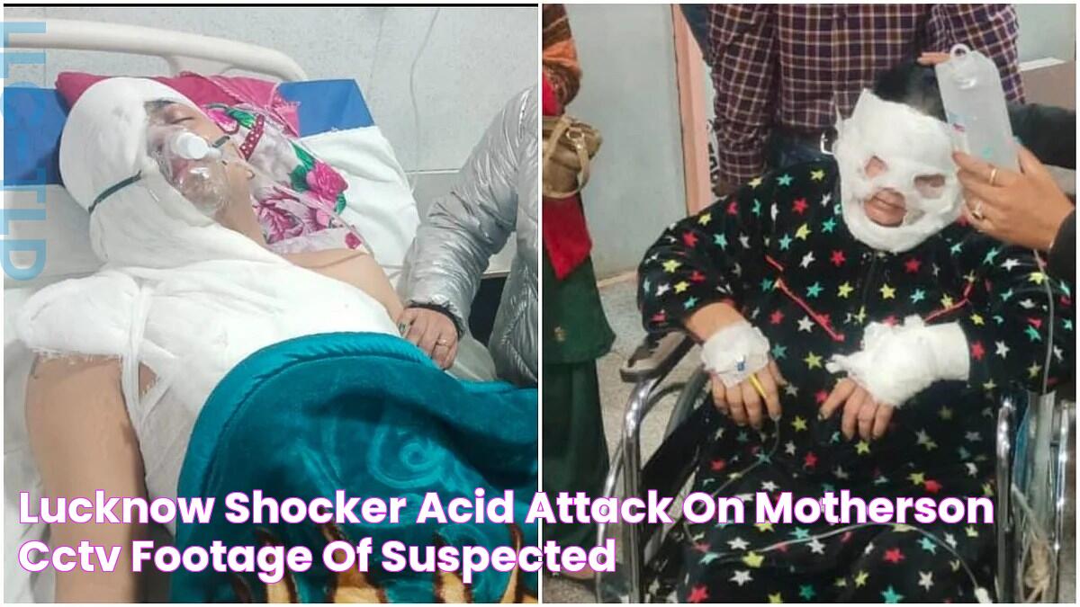 Lucknow Shocker! Acid attack on motherson; CCTV footage of suspected