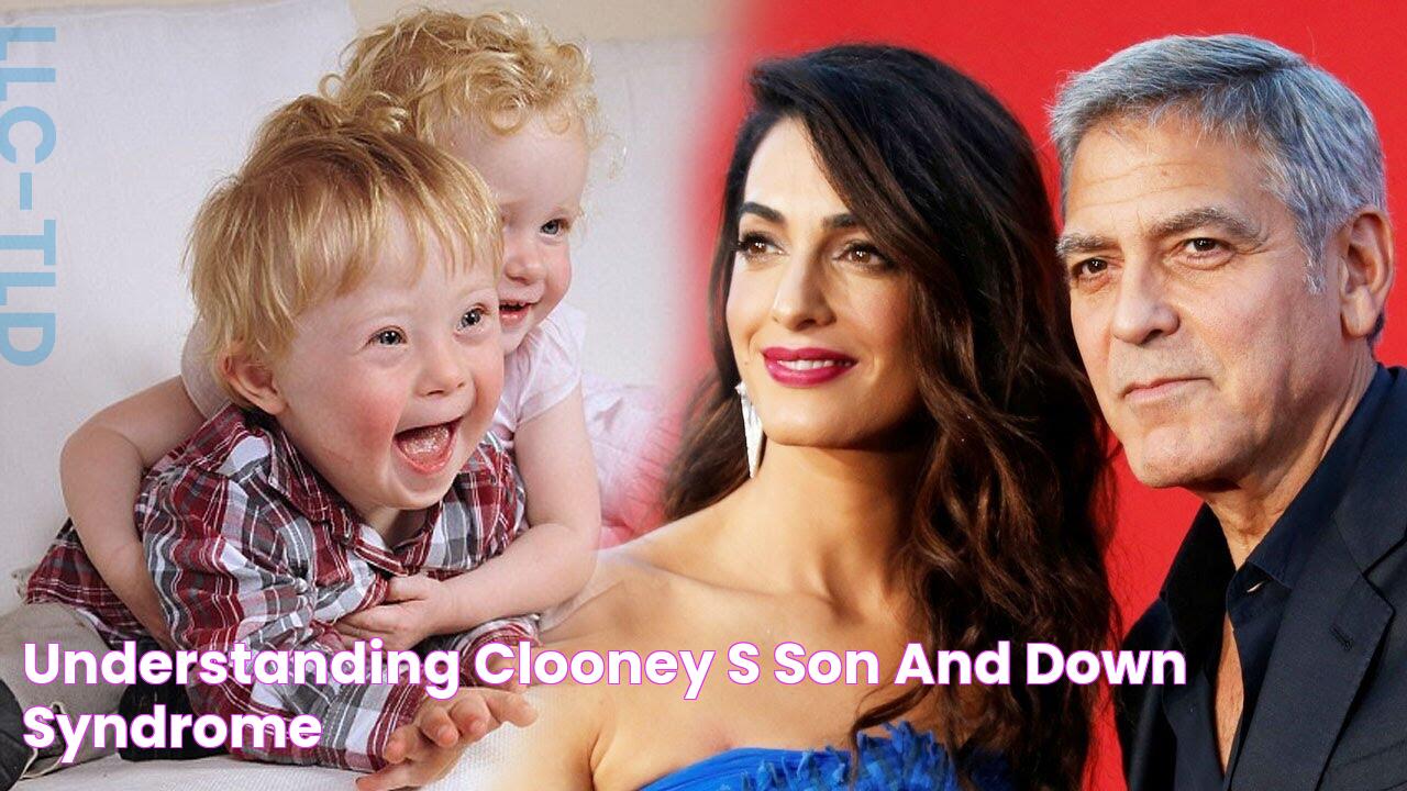 Understanding Clooney's Son And Down Syndrome