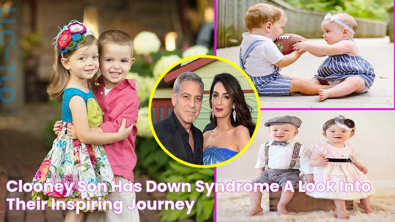 Clooney Son Has Down Syndrome A Look Into Their Inspiring Journey