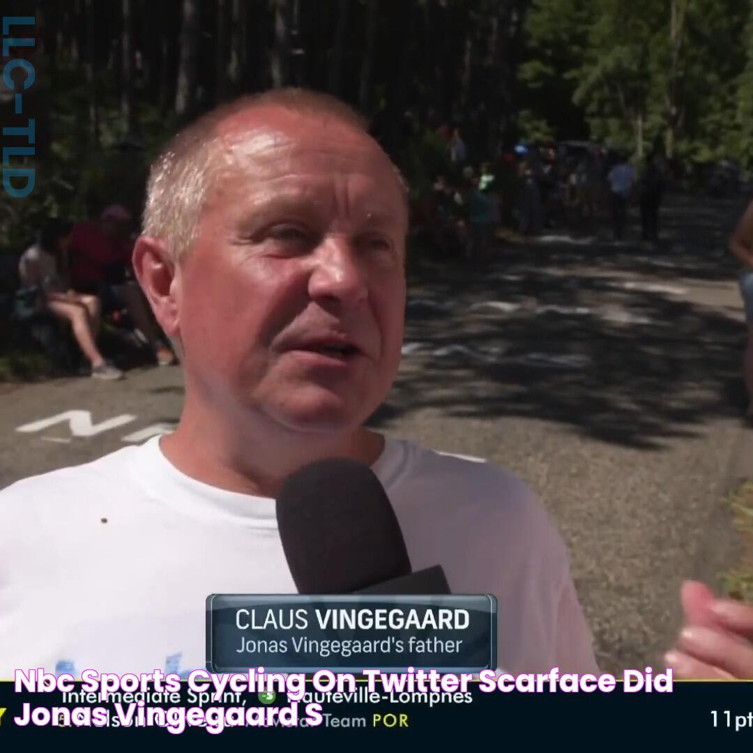 NBC Sports Cycling on Twitter ""Scarface"? 😂 Did Jonas Vingegaard's